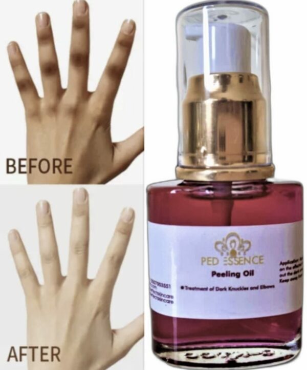PedEssence - Peeling Oil - Image 13