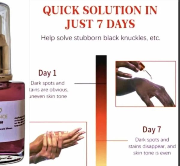 PedEssence - Peeling Oil - Image 9