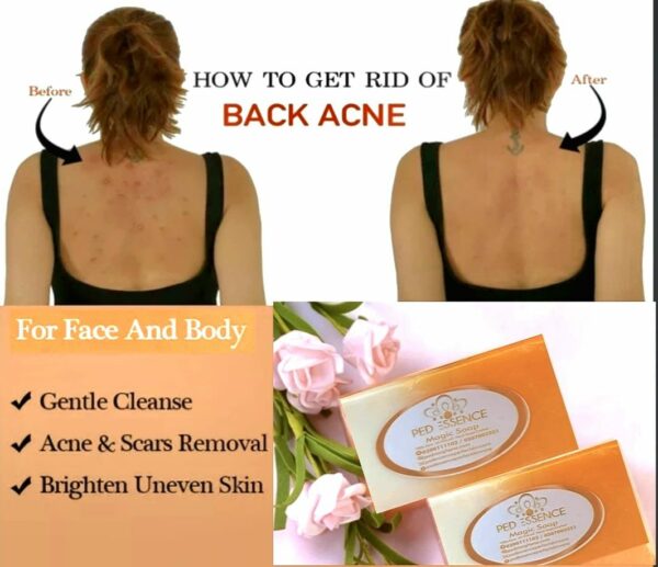 PedEssence - Magic Bar Soap - Image 4