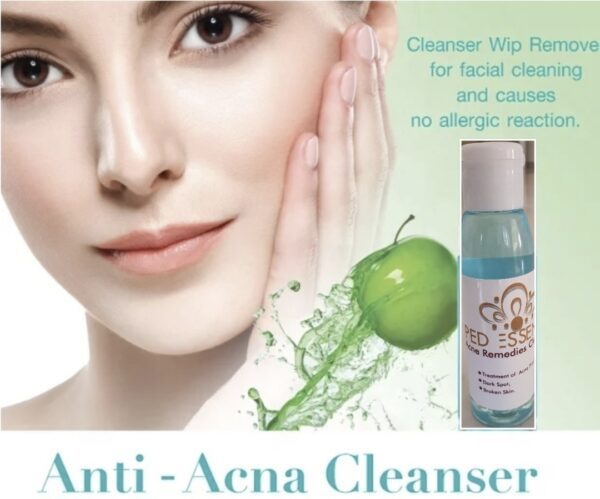 PedEssence - Acne Control Remedies Cleanser - Small - Image 3