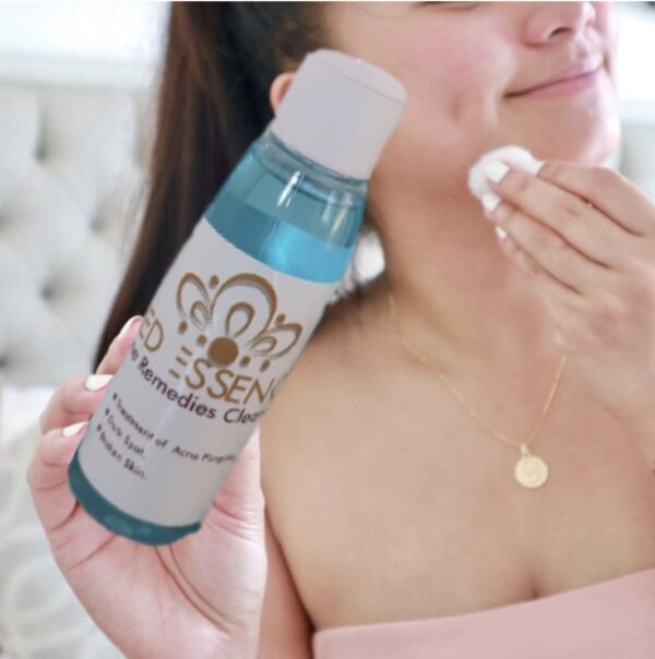 PedEssence - Acne Control Remedies Cleanser - Small - Image 2