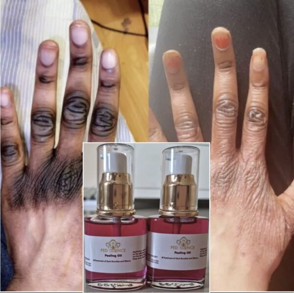 PedEssence - Peeling Oil - Image 8